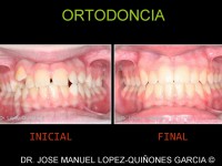 097-ortodoncia