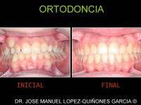 098-ortodoncia